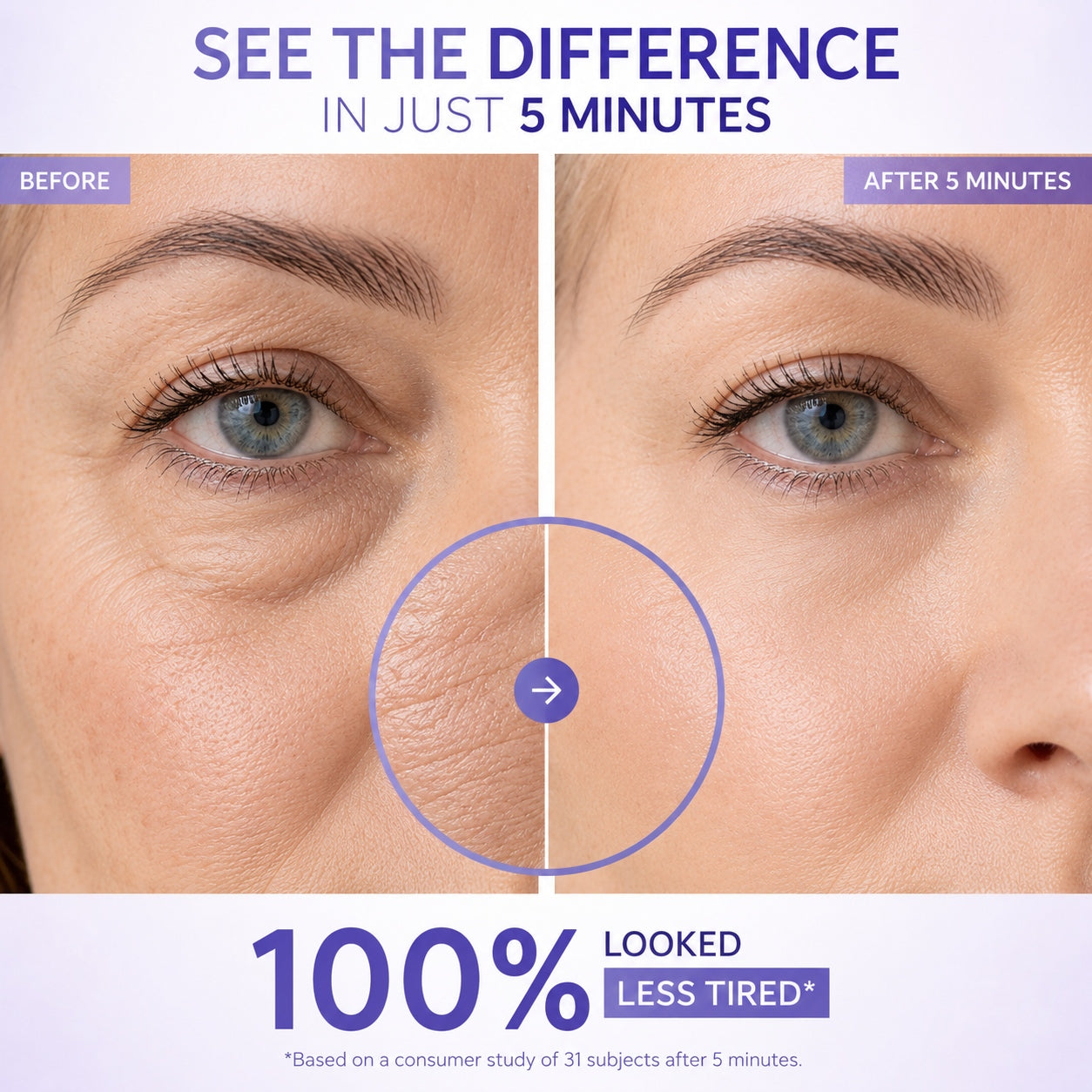 BOLEJOY Instant Lift Eye Gel – Advanced Under-Eye Tightening Technology for Puffiness, Fine Lines & Tired Eyes-9YB