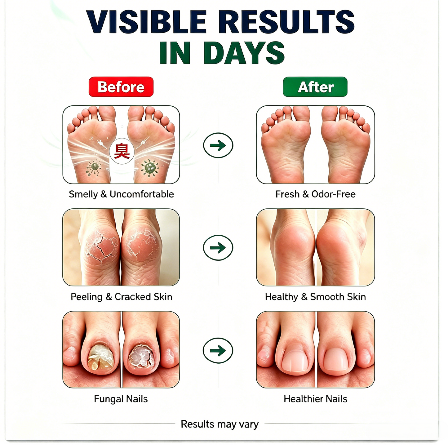 Tea Tree Foot Spray – Eliminates Odor, Fights Fungus & Refreshes Feet Instantly-9YB