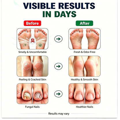 Tea Tree Foot Spray – Eliminates Odor, Fights Fungus & Refreshes Feet Instantly-9YB