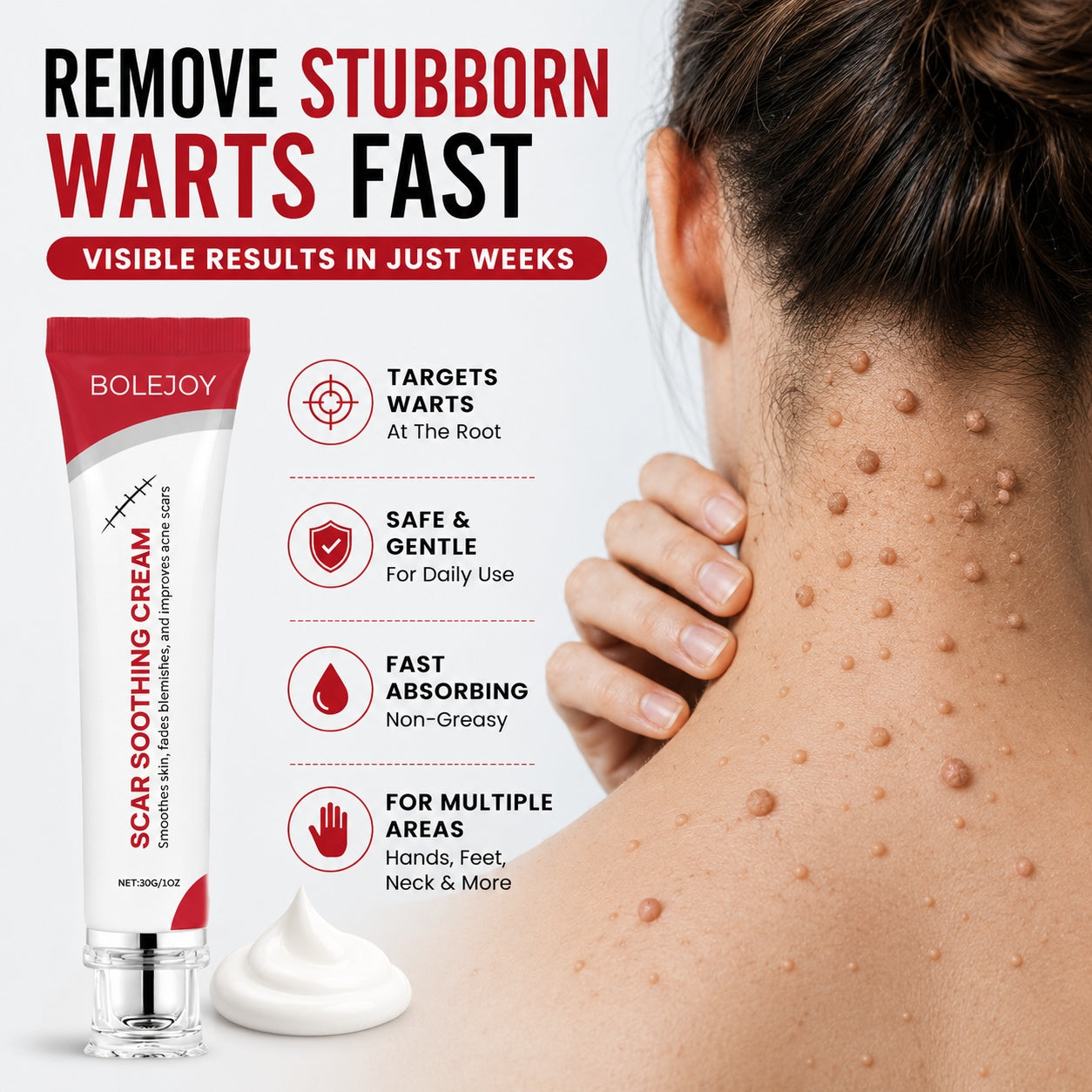 Remove Stubborn Warts Without Painful Treatments-9YB