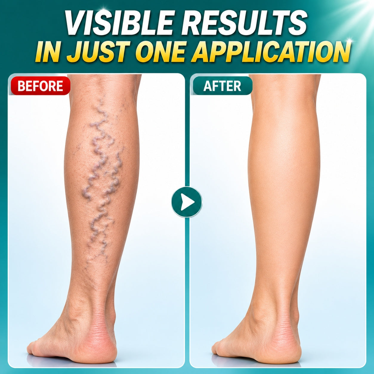 SAY GOODBYE TO HEAVY, ACHING LEGS-9YB