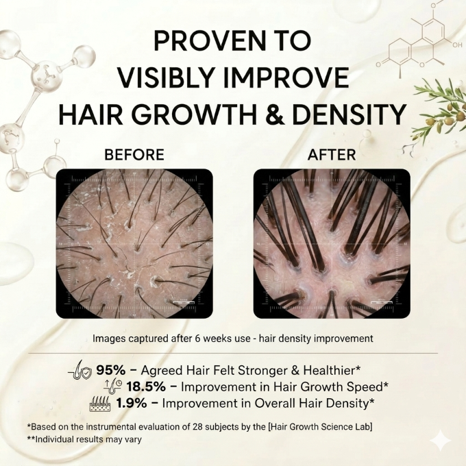 Bolejoy Hair Growth Cream -Regrow Fuller & Thicker Hair-9YB