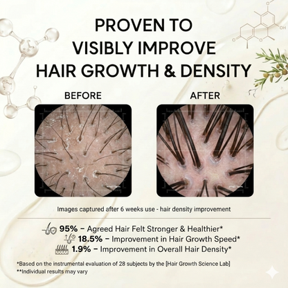 Bolejoy Hair Growth Cream -Regrow Fuller & Thicker Hair-9YB