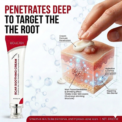 Remove Stubborn Warts Without Painful Treatments-9YB