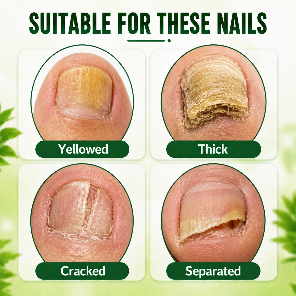 BOLEJOY Hyaluronic Acid Nail Hardener for Weak, Brittle & Dull Nails-9YOE9