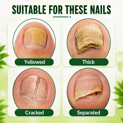 BOLEJOY Hyaluronic Acid Nail Hardener for Weak, Brittle & Dull Nails-9YOE9