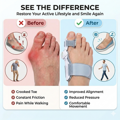 Unisex orthopedic hallux valgus splint-self-adjusting orthopedic toe sleeve, common to left and right feet-9YB