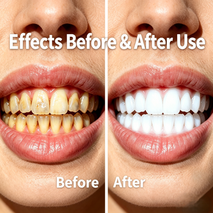 Charcoal Teeth Whitening Strips-9YB